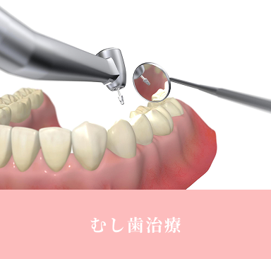 top_feature_flex_image01