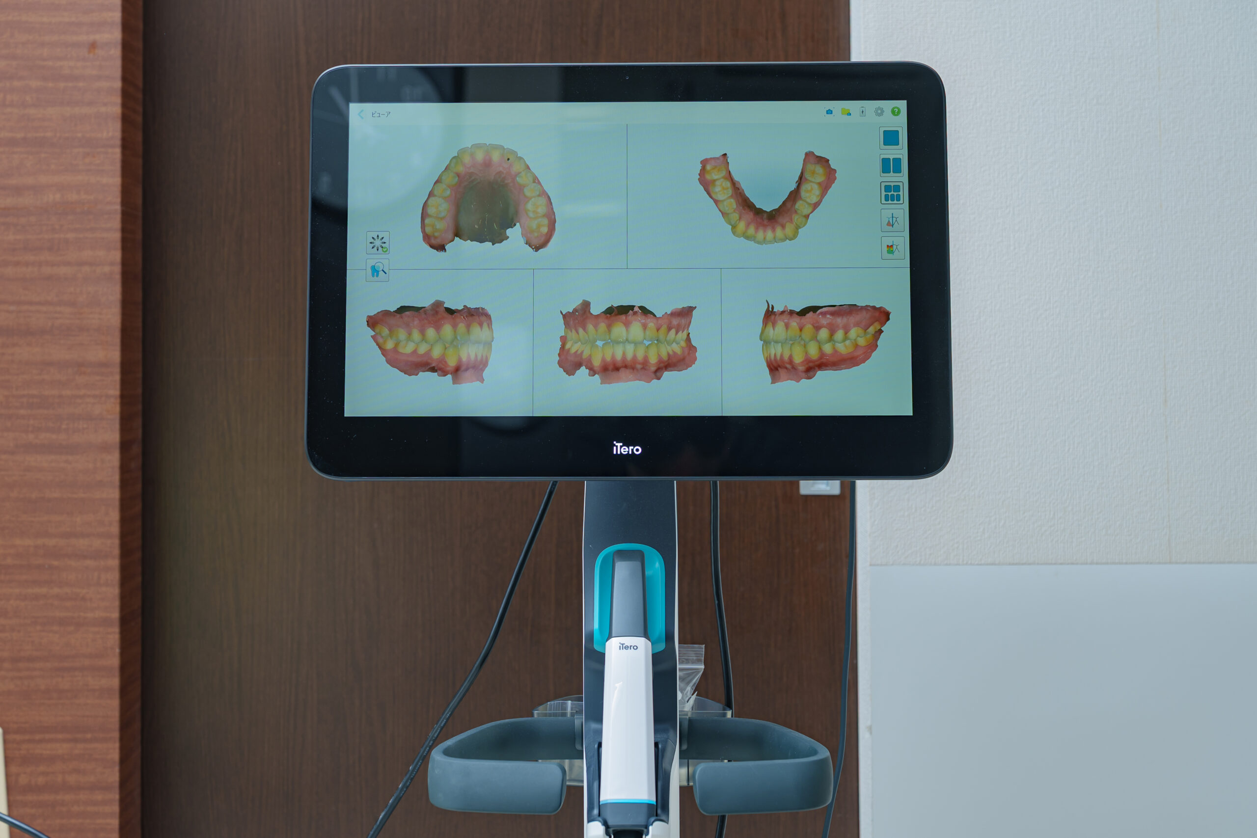 top_feature_contents05_image