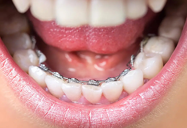 equipment_type_image05