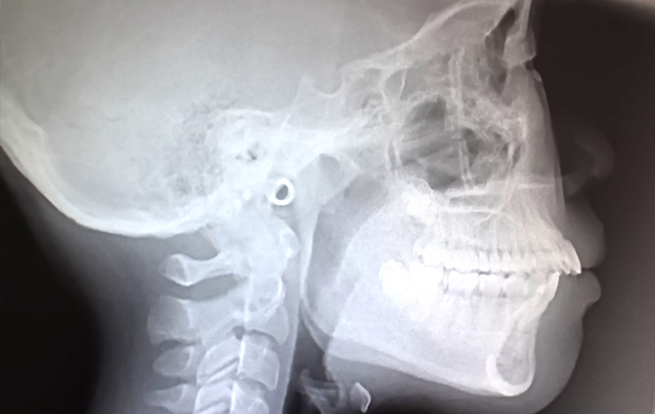 top_feature_flex_right