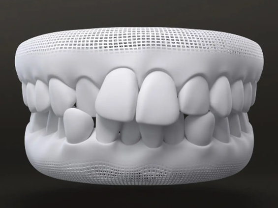 top_feature_tooth_image