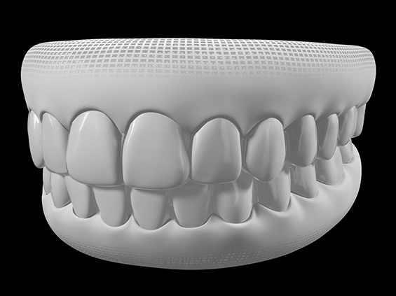 top_feature_tooth_image